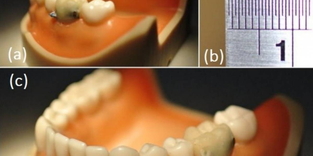 Científicos desarrollan sensor dental que detecta cuando fumamos o tosemos