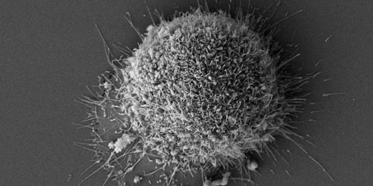 Estudiante de 17 años desarrolla nanopartícula que mata células cancerígenas