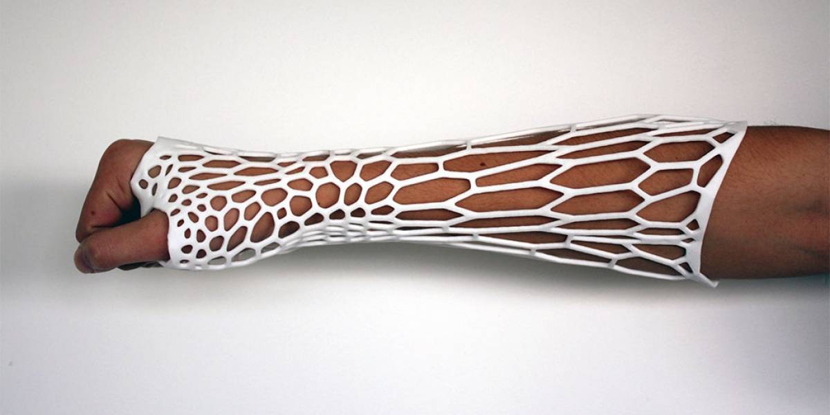 Cortex: Una férula impresa en 3D que ayudará a sanar tu brazo roto