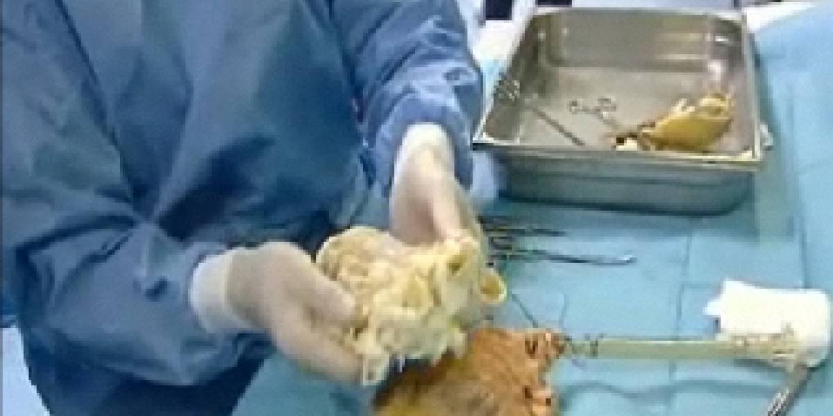 España: Crearán órganos bioartificiales para trasplantes