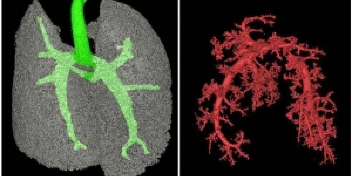 Científicos logran crear pulmones cultivados en el laboratorio