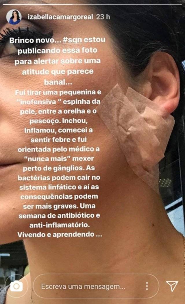 espinha