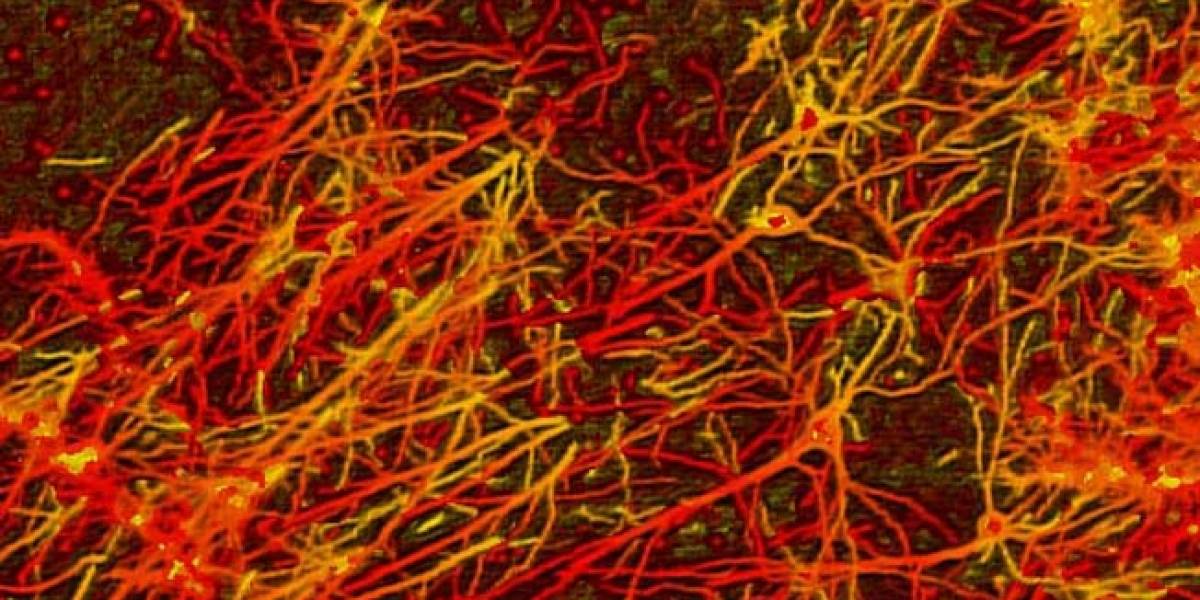 Estudio demuestra la rapidez con que olvidamos información: 1 bit por segundo por neurona