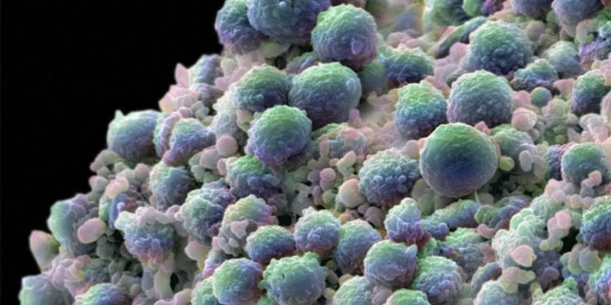 La primera vacuna exitosa contra el cáncer ya es una realidad