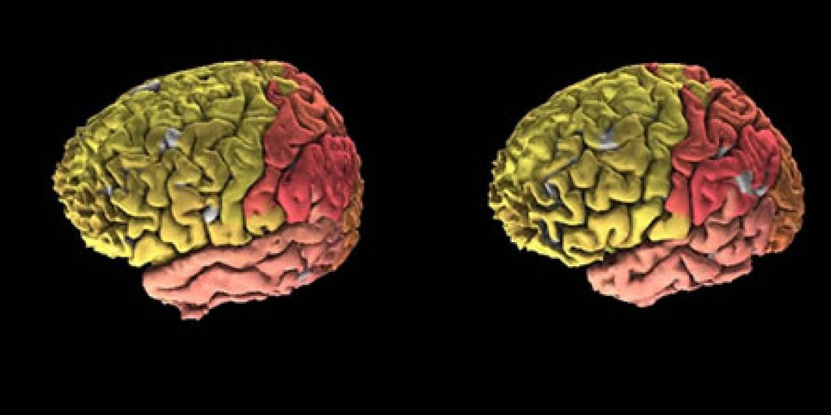 Instituto de Paul Allen lanza primer atlas del cerebro