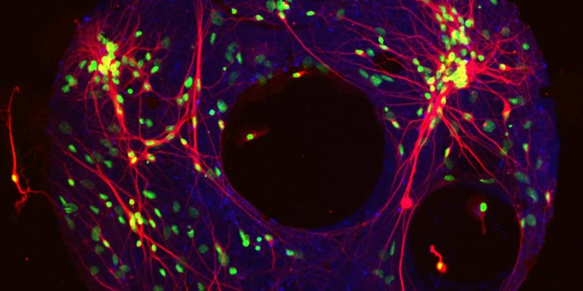 Cerebro de laboratorio logra una memoria de 12 segundos