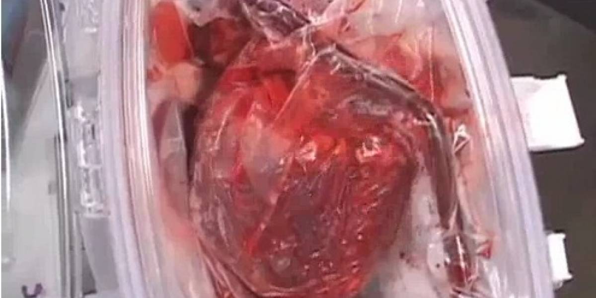 Caja transparente lleva corazones latientes y frescos para sus nuevos portadores
