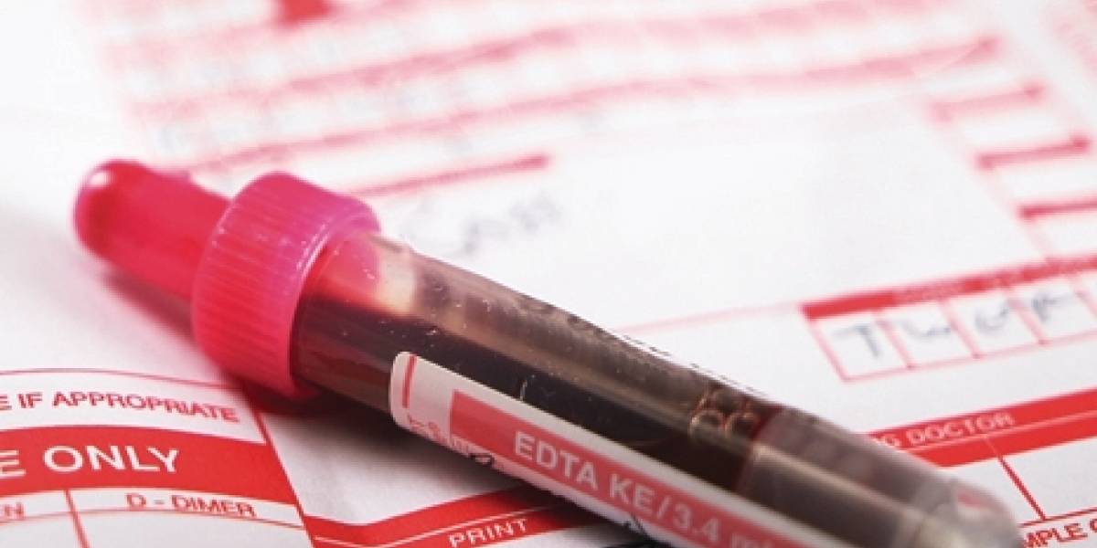 Nuevo examen de sangre detecta la esquizofrenia y va por más enfermedades psiquiátricas