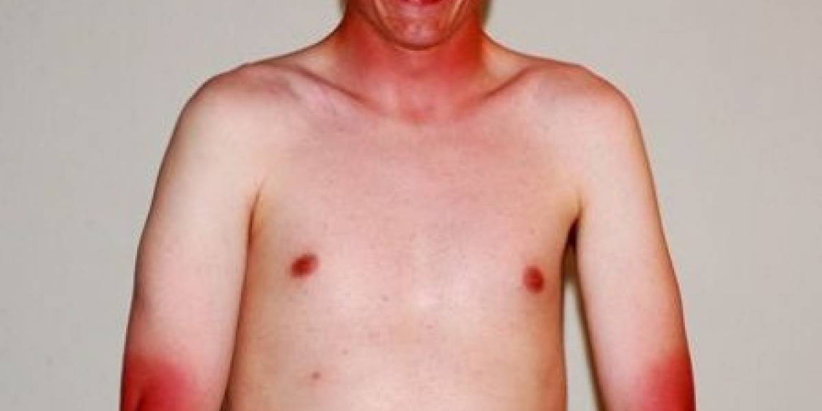 Pronto podremos quemarnos al sol como jaibas sin querer morirnos del dolor
