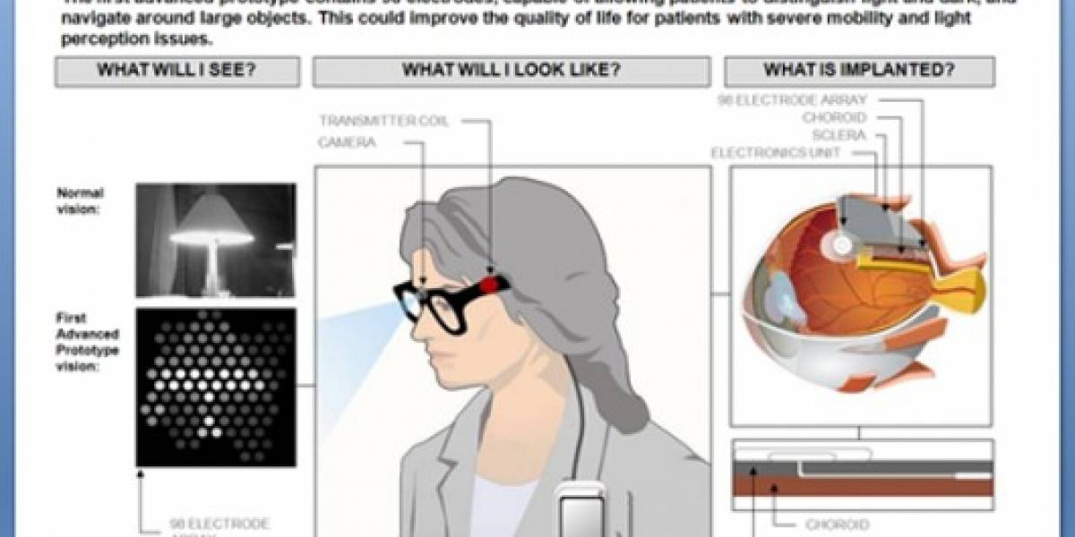 Australianos crean prototipo avanzado de Visión Biónica