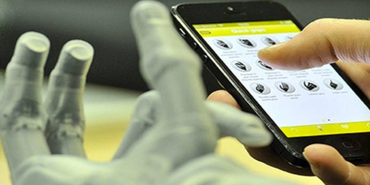 Paciente utiliza prótesis de manos robóticas que se controlan vía un teléfono móvil