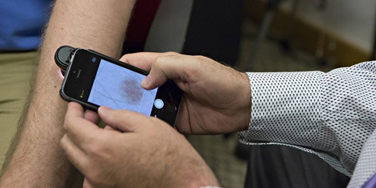 Crean aplicación para iPhone que detecta el cáncer a la piel