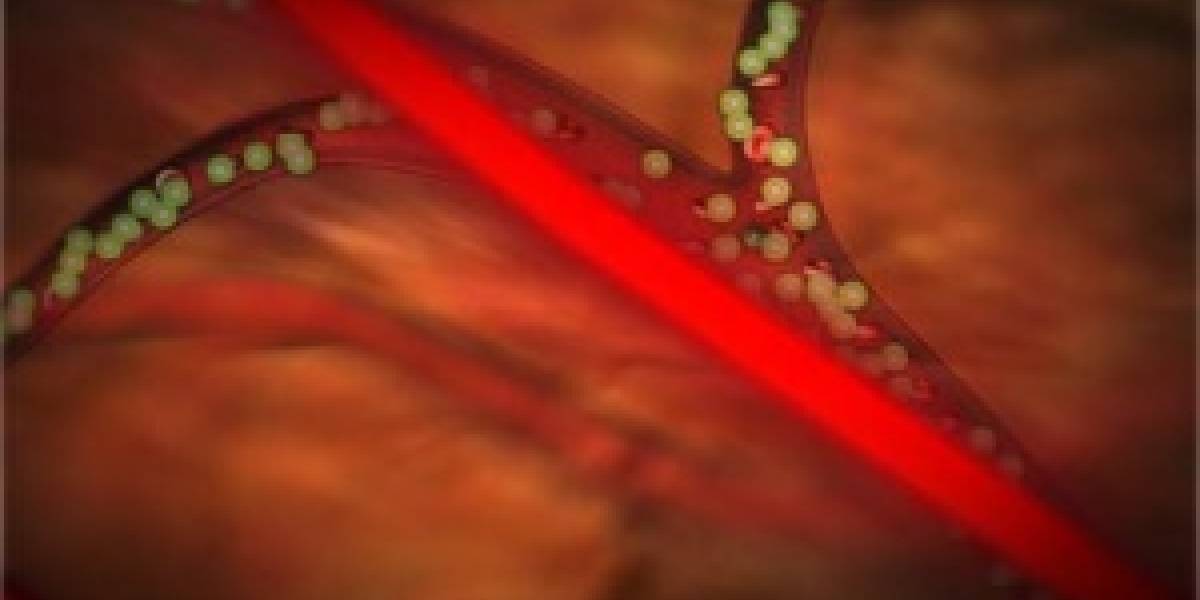 Micro burbujas mejoran los tratamientos contra el cáncer y sus efectos secundarios