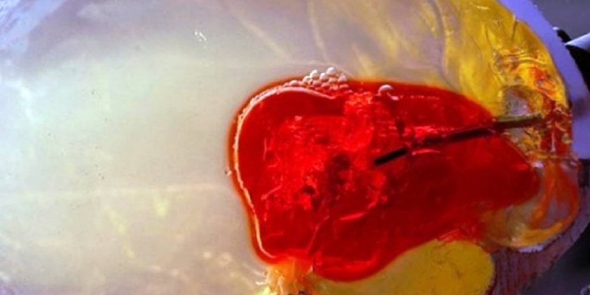 Desarrollan aguja robótica para extraer coágulos cerebrales