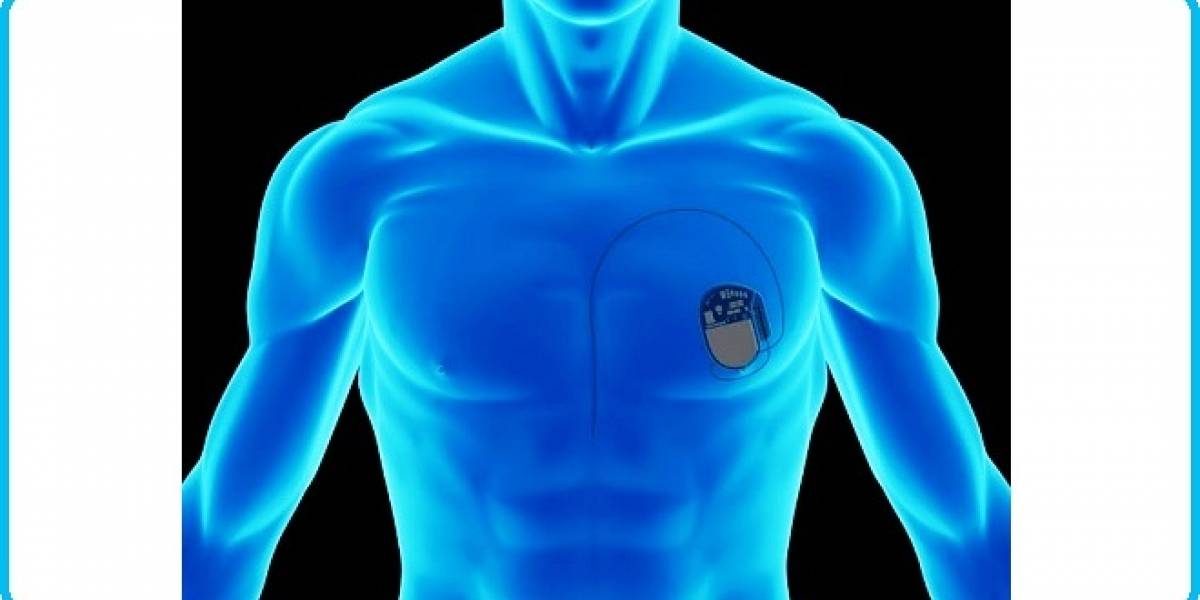 La FDA de los EEUU insta a que se mejore la ciberseguridad de los dispositivos médicos