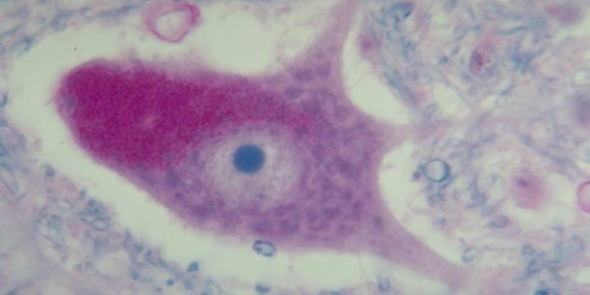 Científicos logran crear neuronas a partir de muestras de sangre