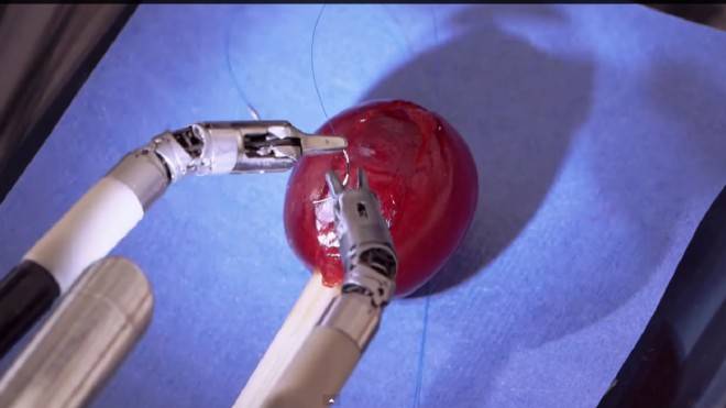 Médicos logran crear pistola de pegamento para reemplazar los puntos de sutura Médicos logran crear pistola de pegamento para reemplazar los puntos de sutura