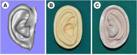 Cientistas escanearam as orelhas e transferiram os dados para a impressora 3D, criando um molde novo (Foto: Reprodução/EBioMedicine)