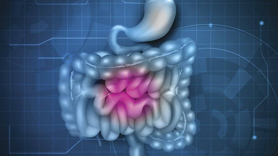  Gráfico de un intestino