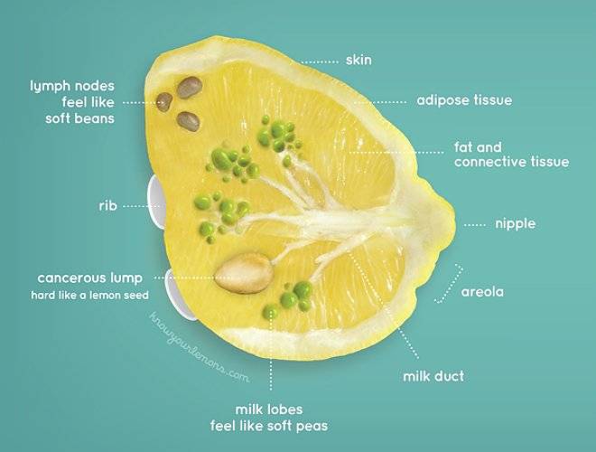 knowyourlemonsdotcomselfexam1.jpg