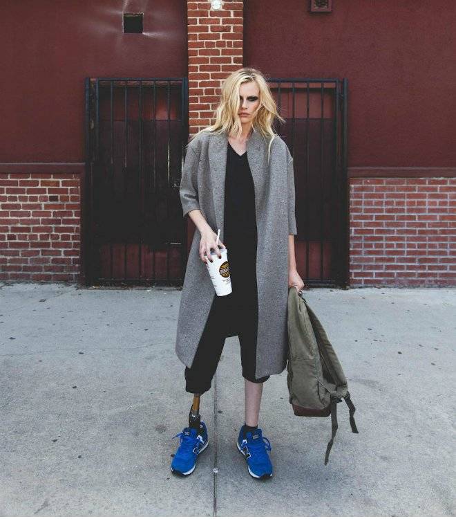 meetthemodelwholostherlegtotoxicshocksyndrome611bodyimage1434040063.jpg