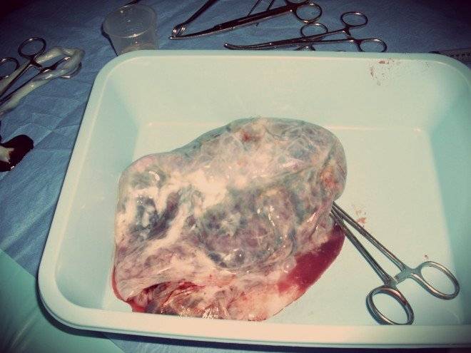 placenta2026401920660x650.jpg