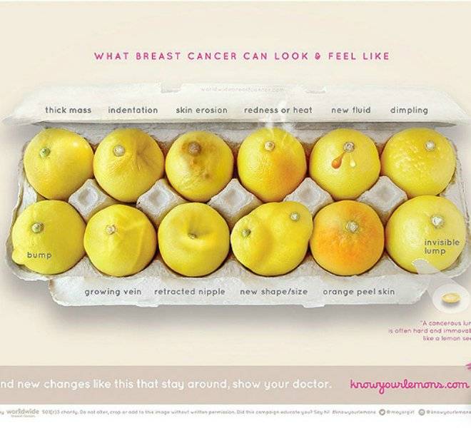 whatbreastcancercanlookfeellike91.jpg