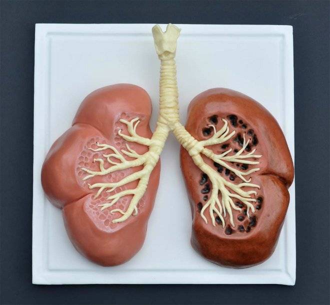 lungcake.jpg