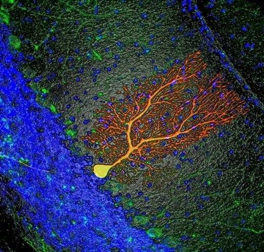 purkinjenervecell.jpg