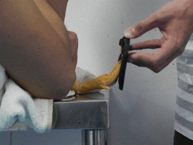 quackquackbrace660x550.jpg