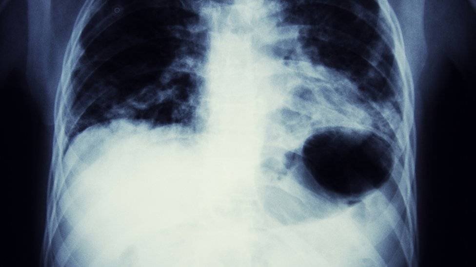 100041657radonradiografia-e271aadd3277859ef78d9d473b3ba64b.jpg