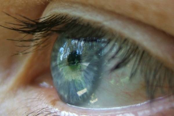cómo evitar tener los ojos hinchados por la mañana