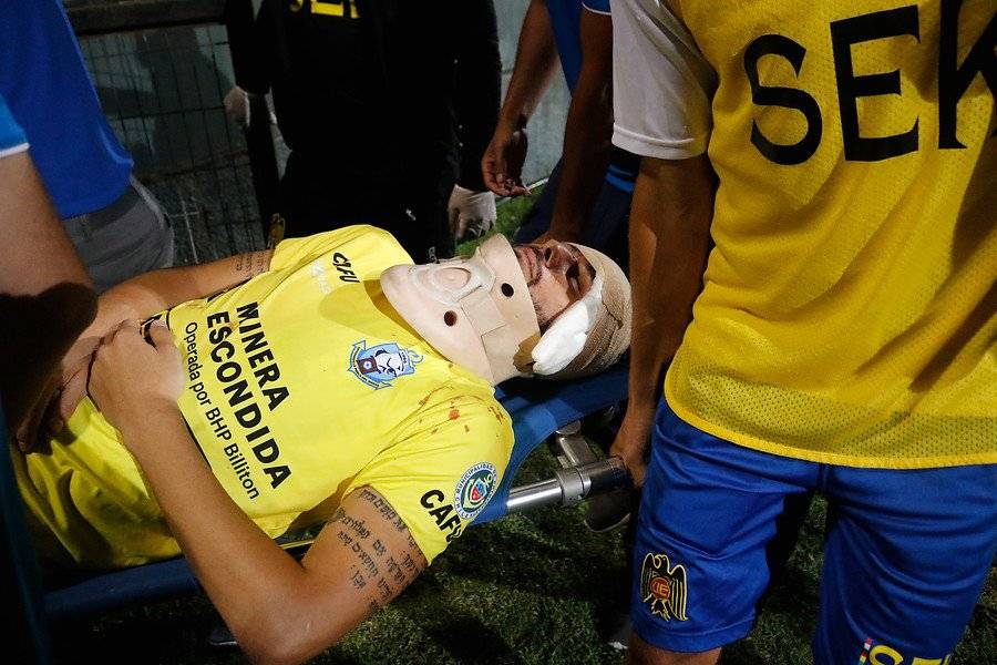 Paulo Garcés debió salir del campo a los 20