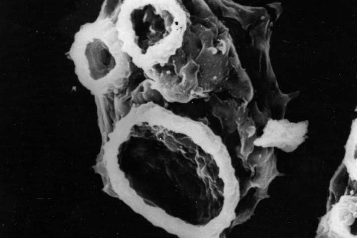 ameba naegleria fowleri chile ameba naegleria fowleri chile