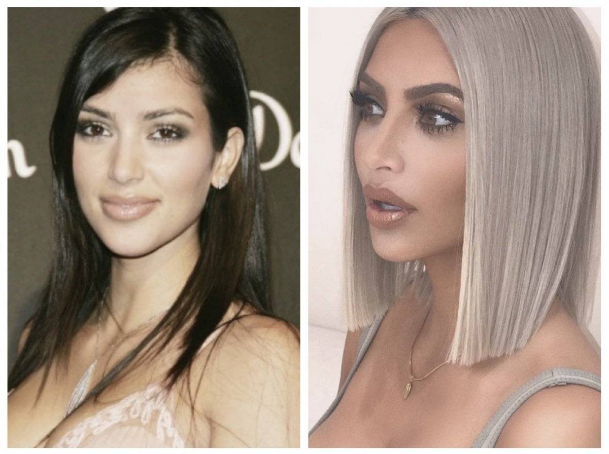 KIM
