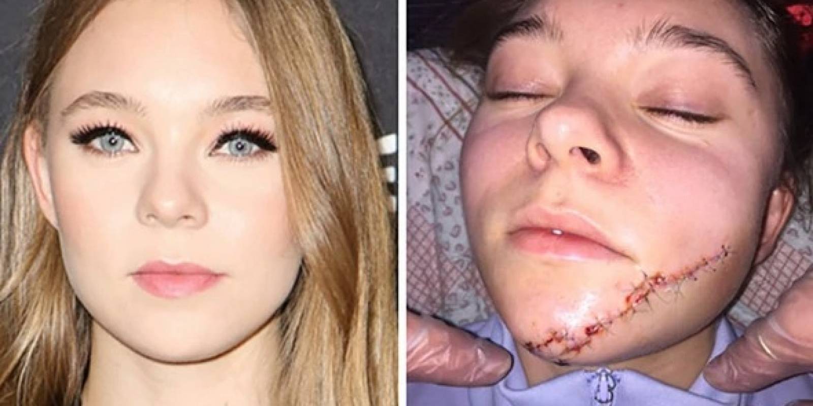 Taylor Hickson: la actriz que terminó con su rostro desfigurado por grabar “Ghostland” 1 Taylor Hickson Ghostland Accidente