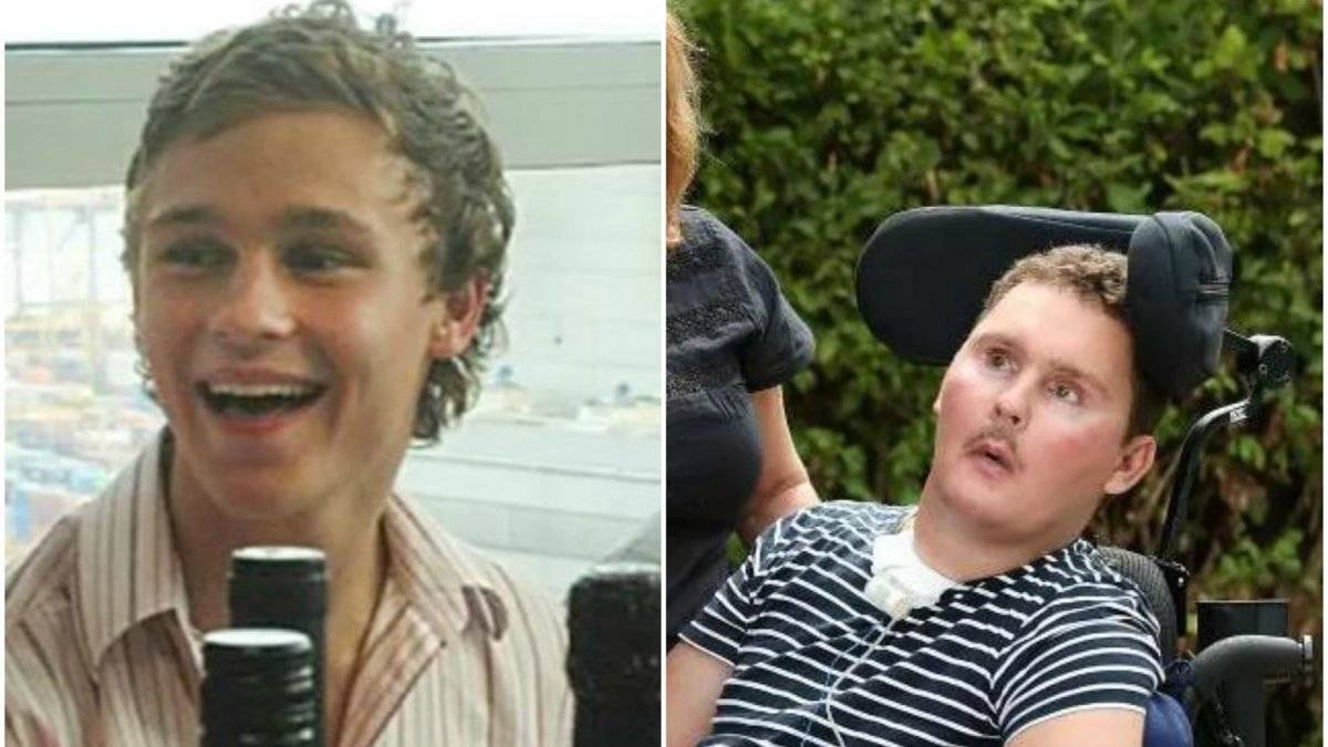 Antes y después de Sam Ballard