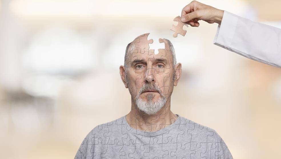 Alzheimer
