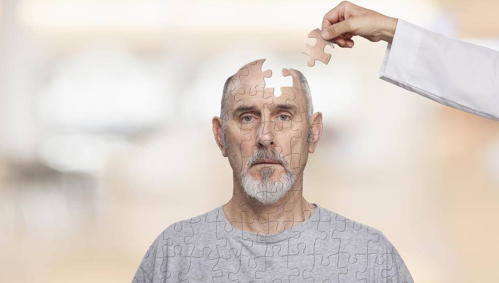 Alzheimer