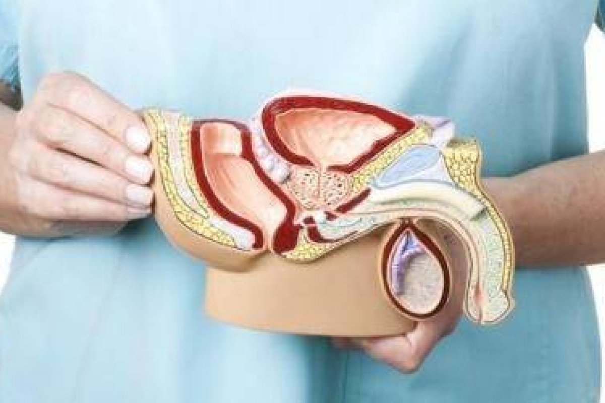causas prostáticas causas prostáticas