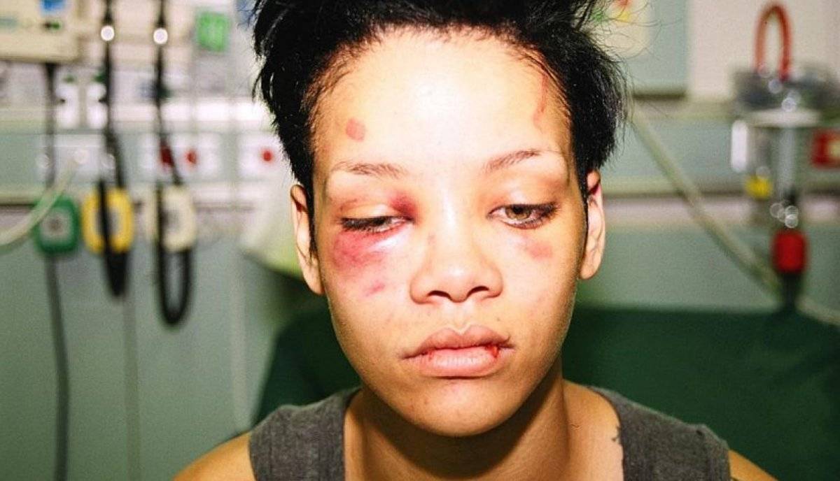 Rihanna golpes
