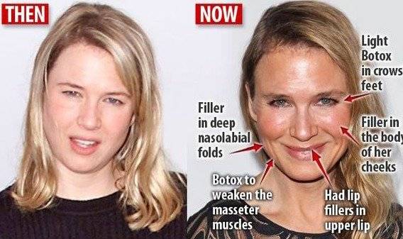renee zellweger