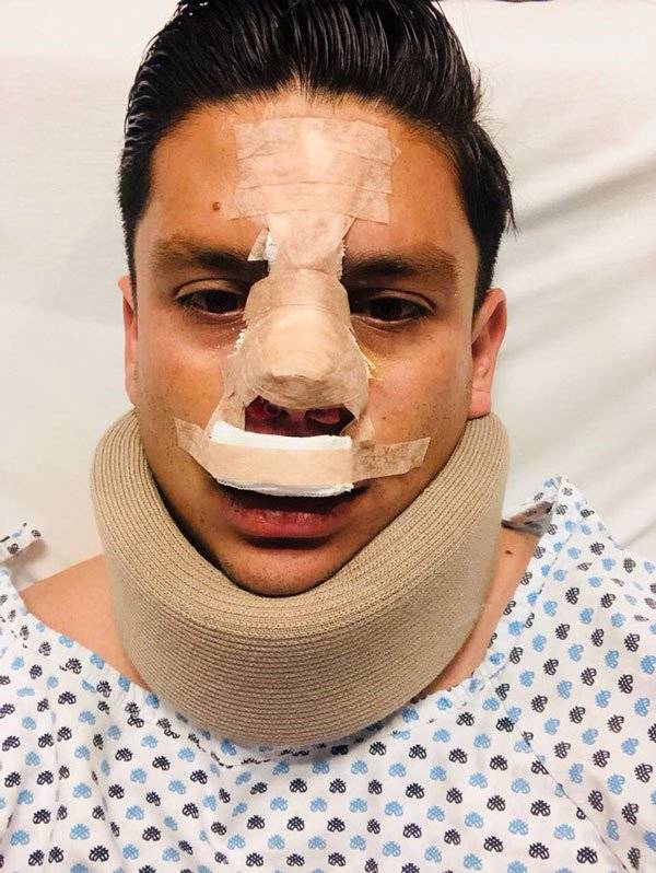 Jugador con lesiones de nariz y cuello