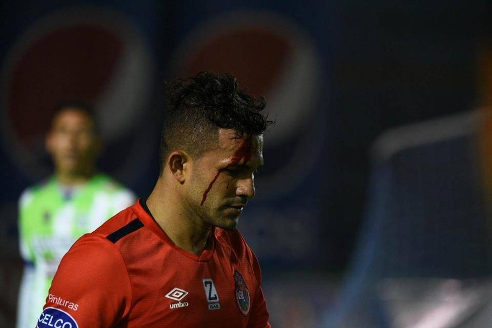 Foto: Douglas Suruy