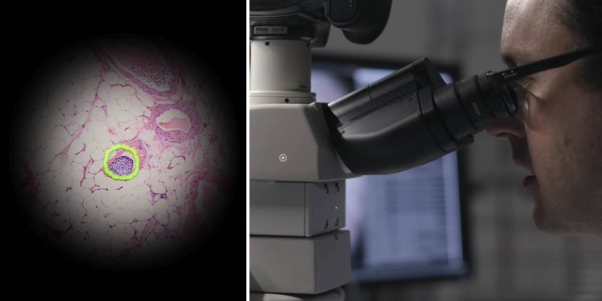 Video: Google presenta impresionante microscopio capaz de detectar el cáncer