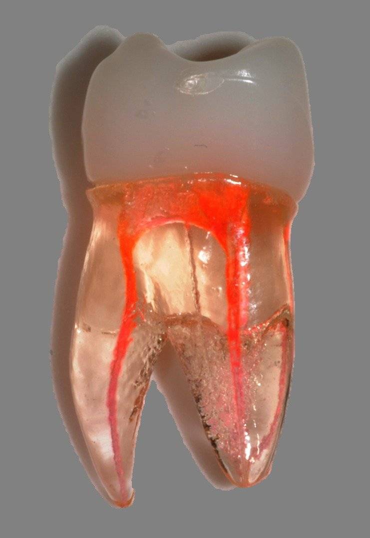 Endodoncia