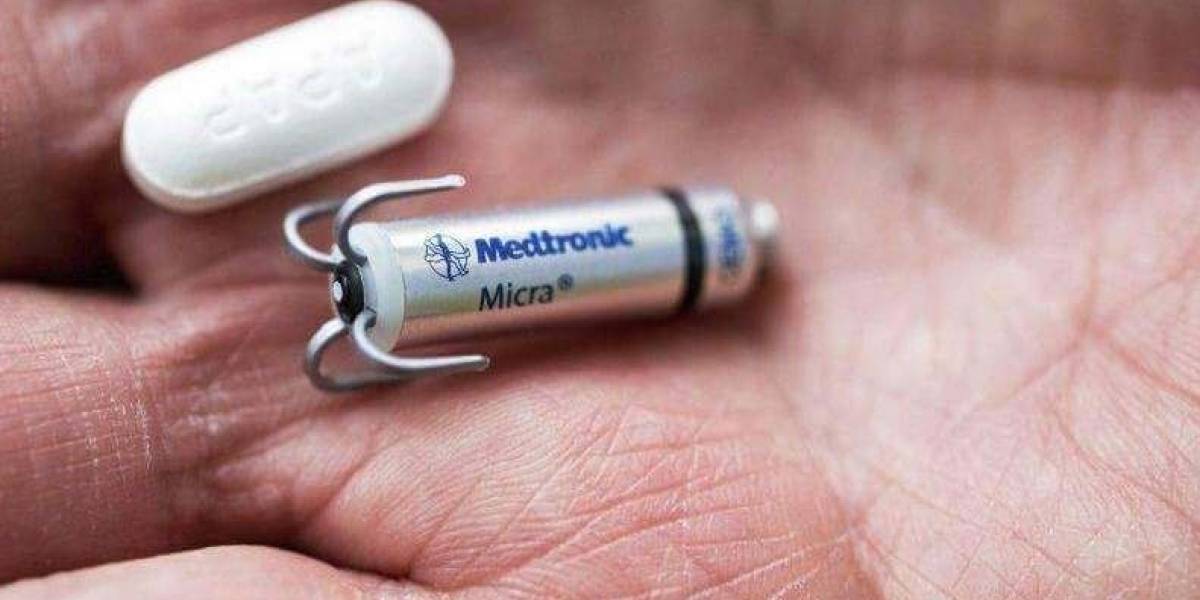 El marcapasos más pequeño del mundo acaba de ser implantado en un chileno