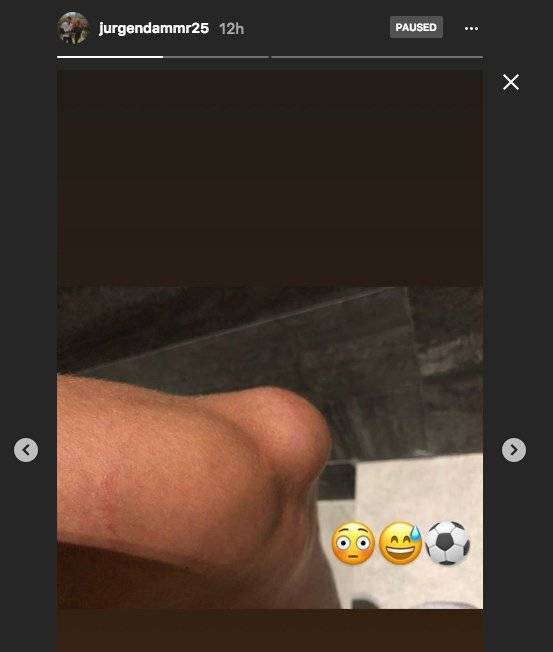 Rodilla Damm