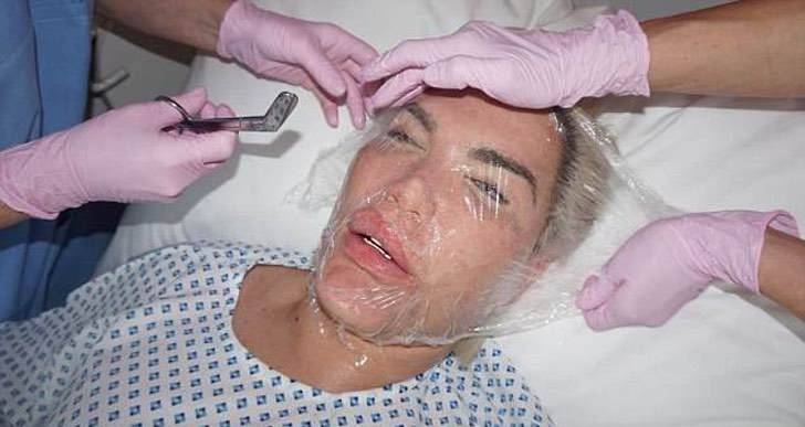 Foto