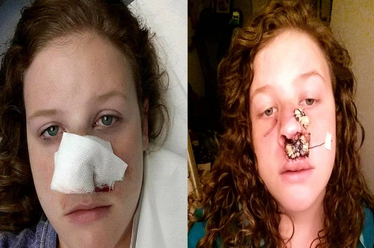 Marisha Dotson cáncer operación